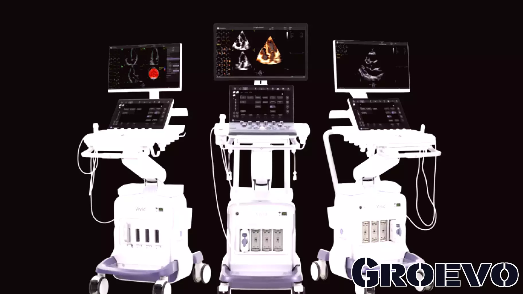 GE HealthCare announces 3 new ultrasound imaging systems